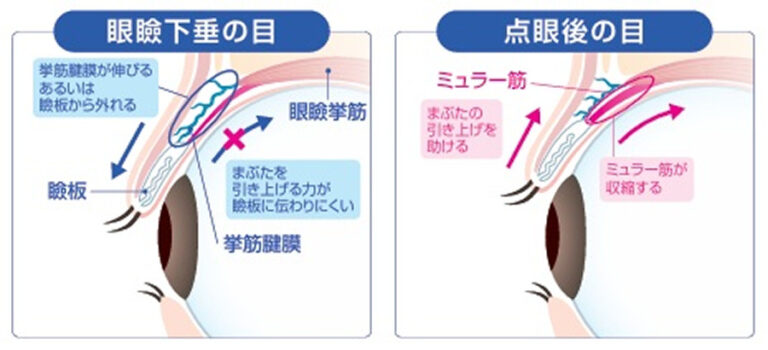 作用機序